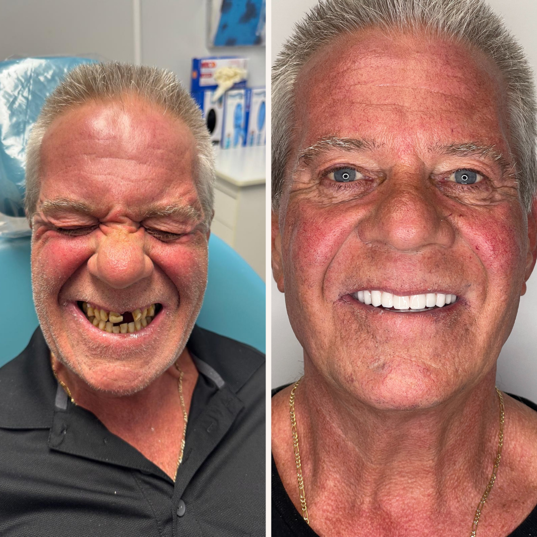 Smyle East Meadow before and after transformation