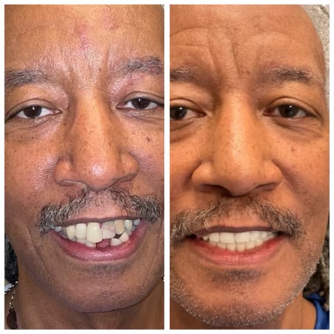 Smyle East Meadow before and after transformation