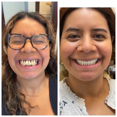 Smyle East Meadow before and after transformation
