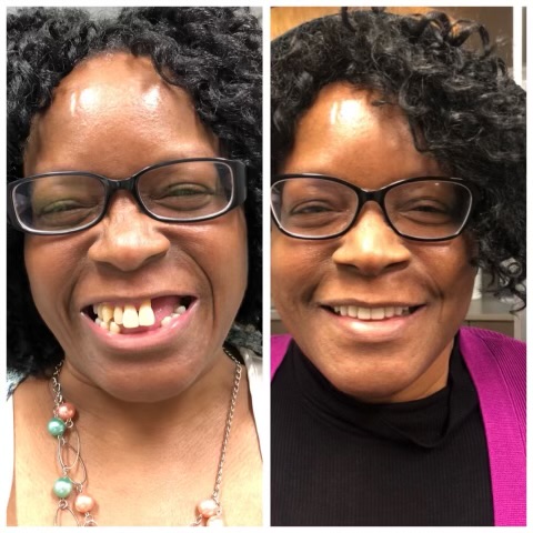 Smyle East Meadow before and after transformation