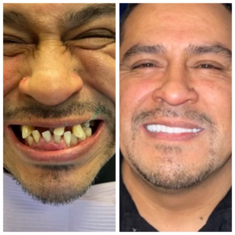 Smyle East Meadow before and after transformation