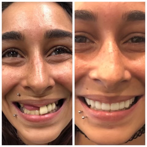 Smyle East Meadow before and after transformation